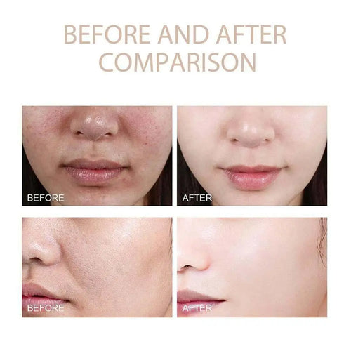 Dr. Melaxin Rice Peel Shot Bundle