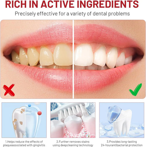 1/2/3pcs Niacinamide Toothpaste Intensive Whitens Teeth Protects Tooth Enamel Freshens Breath 24 Hours Natural Stain Removal